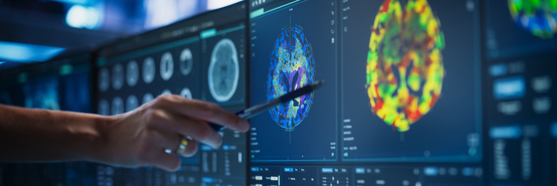 Hand with a pen pointing at colorful brain-scan images displayed on multiple medical monitors.